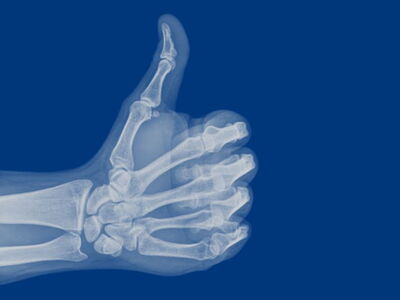 Röntgen-Indikationen