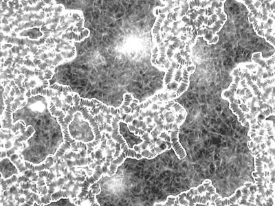 Dunkelfeld-Mikroskopie