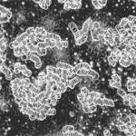 Macrosymprotiten. Möglicherweise grosse Fettträger im Blut (Chylomikronen) (grosse Punkte)